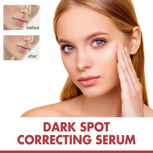 Niacinamide Serum Dark Spot Correcting Moisturizing Brightening Fade Fine Lines Deep Cleaning Makeup Remover Korean Skin Care - Image 2