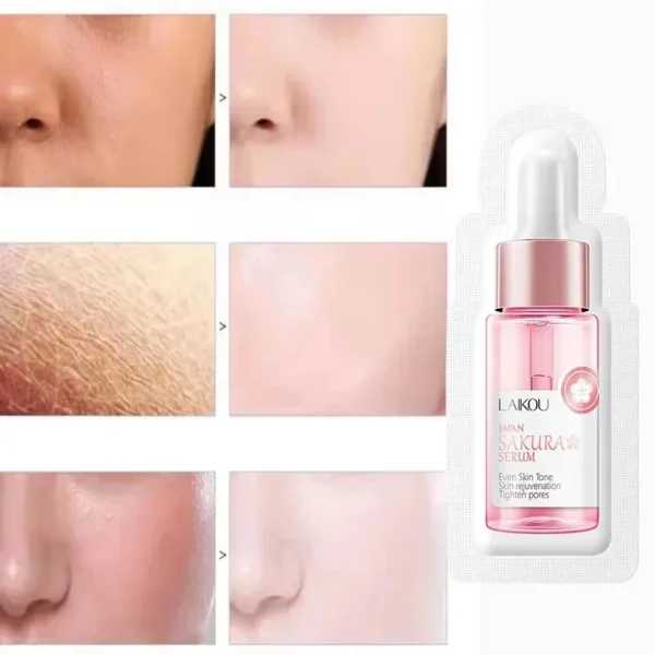 Sakura Whitening Face Serum Fade Fine Lines Anti Aging Tighten Pores Improve Melanin Pigment Dull Moisturizer Brighten Skin Care - Image 2