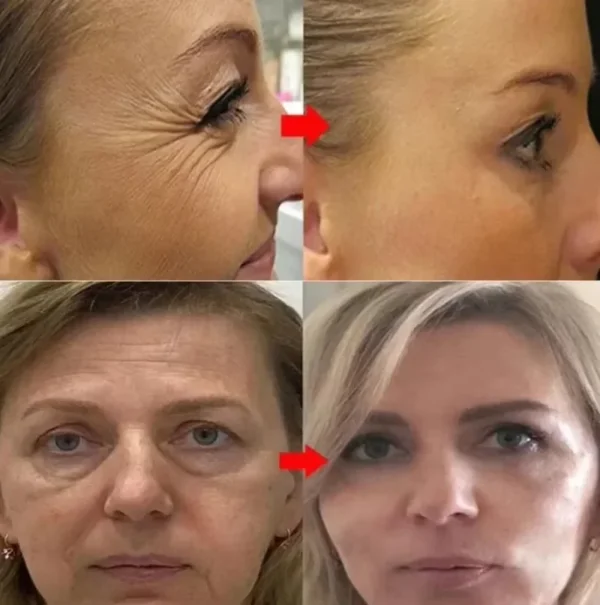 Retinol Remove Wrinkle Face Serum Lift Firming Anti Aging Fade Fine Lines Whitening Brightening Moisturizer Skin Care Cosmetics - Image 2