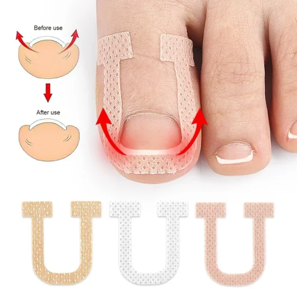 Professional Ingrown Toenail Foot Corrector Stickers Elasticity Toe Nail Care Pedicure Tools Toe Health Care Protects - Image 2