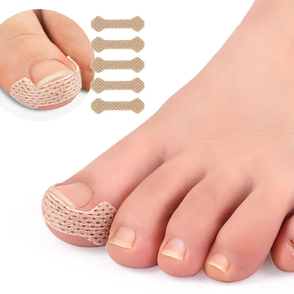 40/100pcs Orthodontic Nail Patch Ingrown Armor and Grow Into Flesh Toe Pad Corrector Pedicure Care Tool professional - Image 6