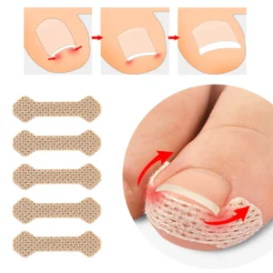 40/100pcs Orthodontic Nail Patch Ingrown Armor and Grow Into Flesh Toe Pad Corrector Pedicure Care Tool professional