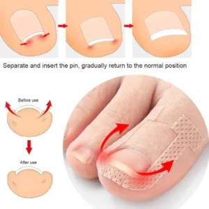 Professional Ingrown Toenail Foot Corrector Stickers Elasticity Toe Nail Care Pedicure Tools Toe Health Care Protects