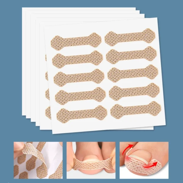 40/100pcs Orthodontic Nail Patch Ingrown Armor and Grow Into Flesh Toe Pad Corrector Pedicure Care Tool professional - Image 5