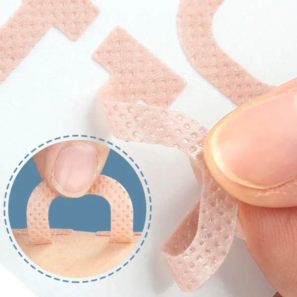 Professional Ingrown Toenail Foot Corrector Stickers Elasticity Toe Nail Care Pedicure Tools Toe Health Care Protects - Image 3