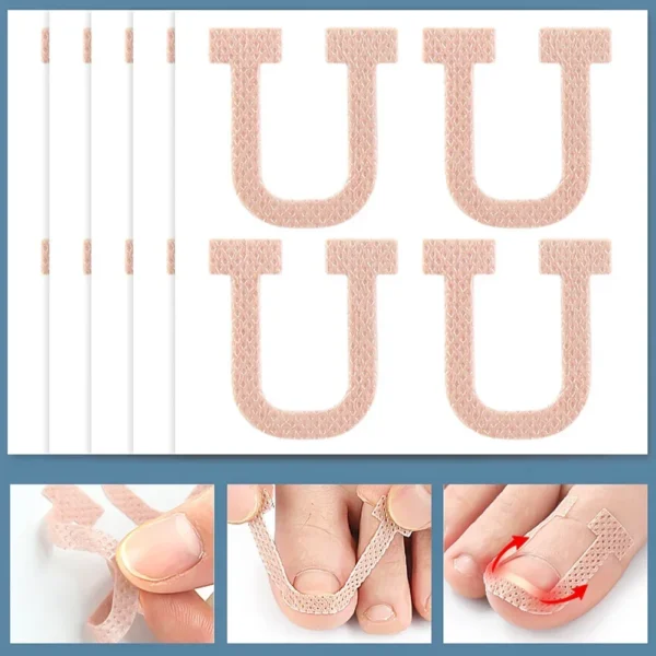 Professional Ingrown Toenail Foot Corrector Stickers Elasticity Toe Nail Care Pedicure Tools Toe Health Care Protects - Image 4
