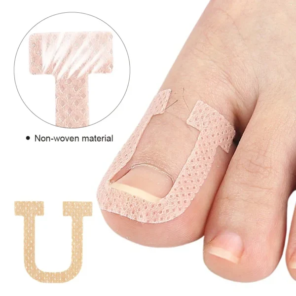 Professional Ingrown Toenail Foot Corrector Stickers Elasticity Toe Nail Care Pedicure Tools Toe Health Care Protects - Image 5