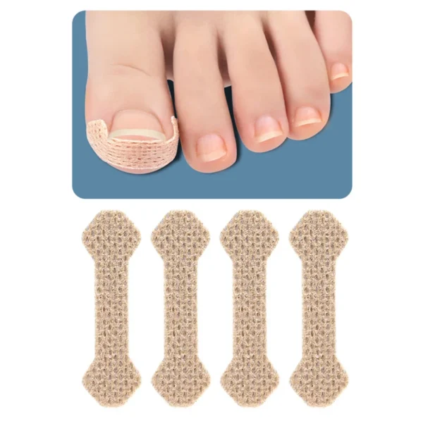 40/100pcs Orthodontic Nail Patch Ingrown Armor and Grow Into Flesh Toe Pad Corrector Pedicure Care Tool professional - Image 4