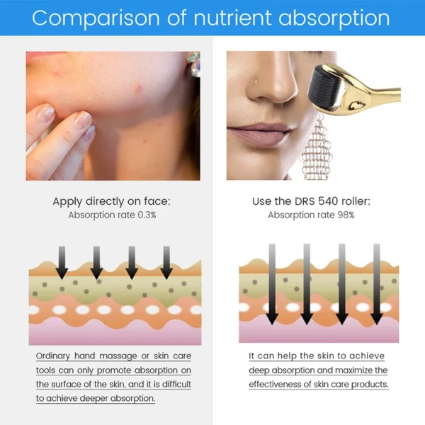 XceeFit Microneedling Roller - Enhance Skin Absorption & Improve Appearance - Image 3